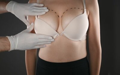 Quels objectifs et quel budget prévoir pour une chirurgie des seins ?