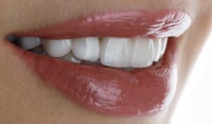 L'esthétique dentaire vous confère des dents blanches esthétiques !