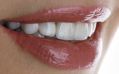 A quoi sert l’esthétique dentaire ?