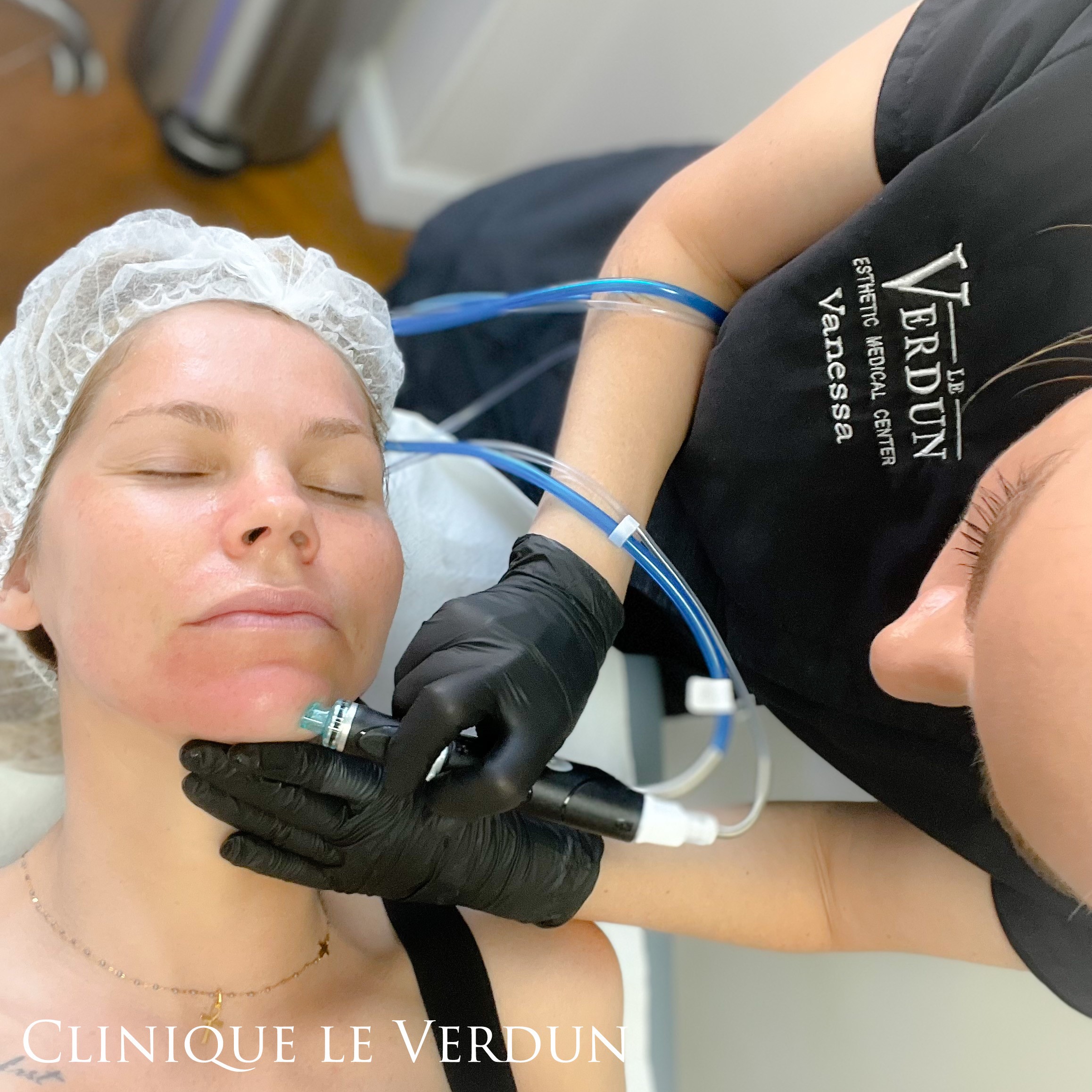 Un soin hydrafacial