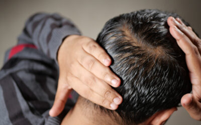 Comprendre le processus de la greffe de cheveux