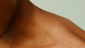 peau bronzé