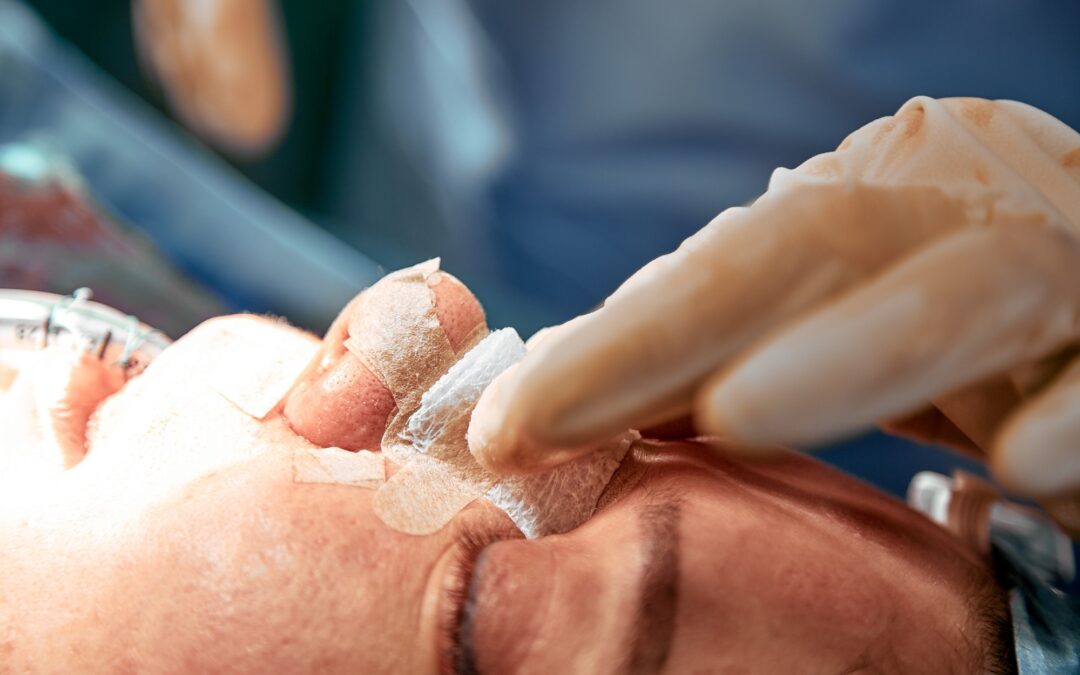 Rhinoplastie ultrasonique : pourquoi opter pour cette technologie de pointe ?