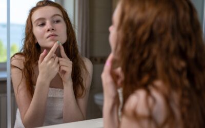 Points noirs, boutons, pores dilatés : pourquoi l’acide salicylique est l’actif idéal ?