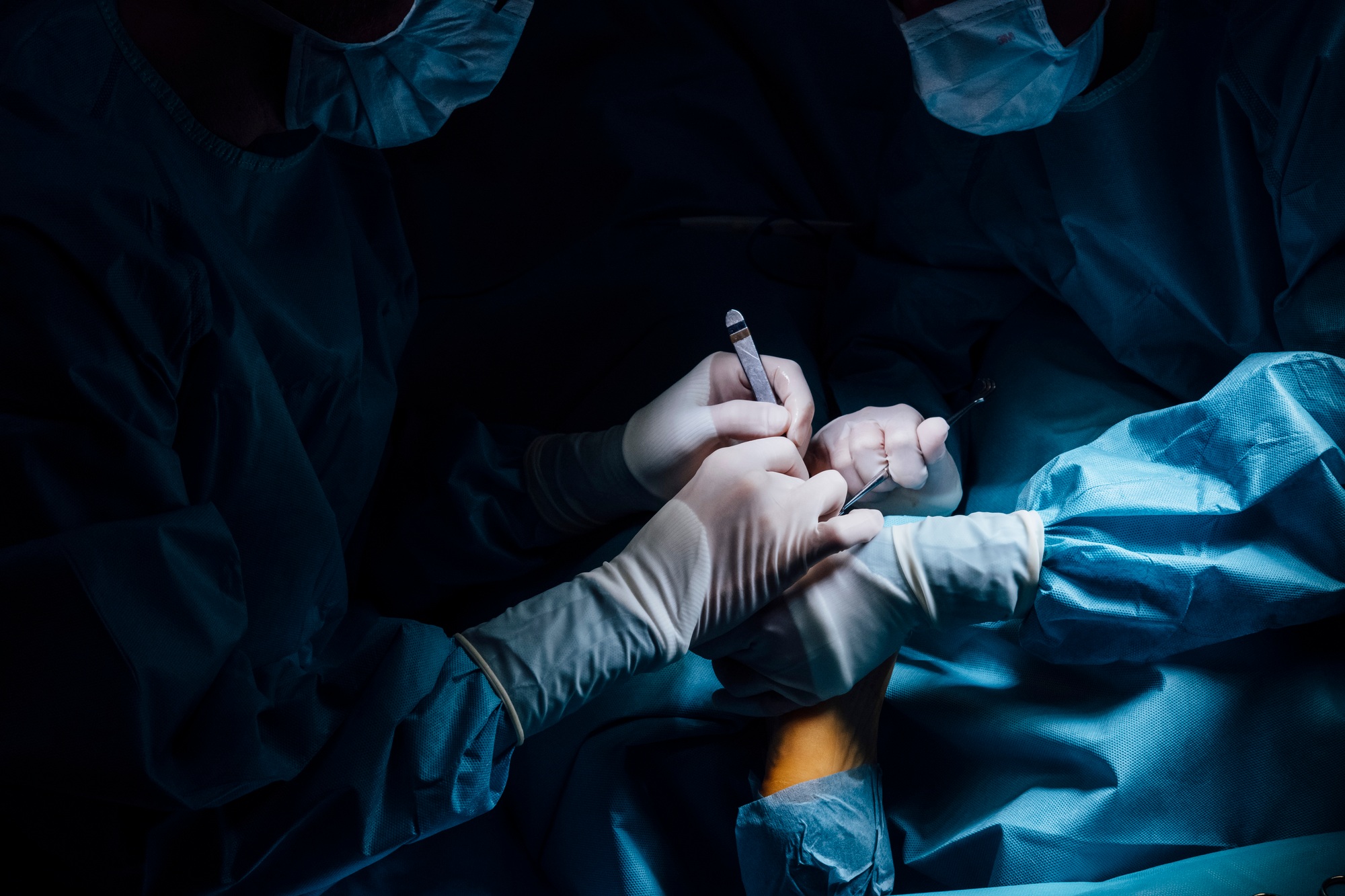chirurgie esthetique