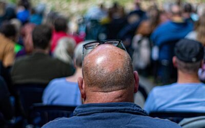 Greffe capillaire FUE : mon parcours avant/après